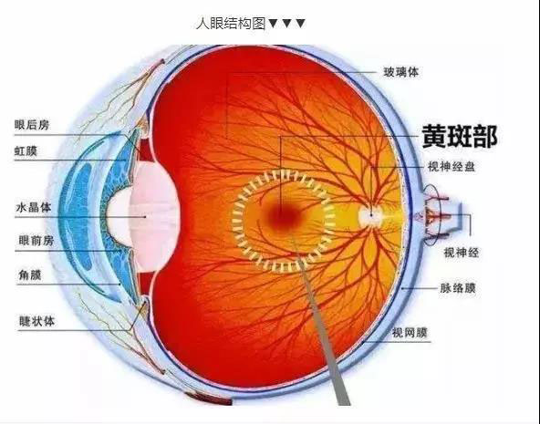 眼底黄斑病是什么引起的!黄斑病变怎样治疗?