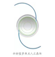 多焦点晶体